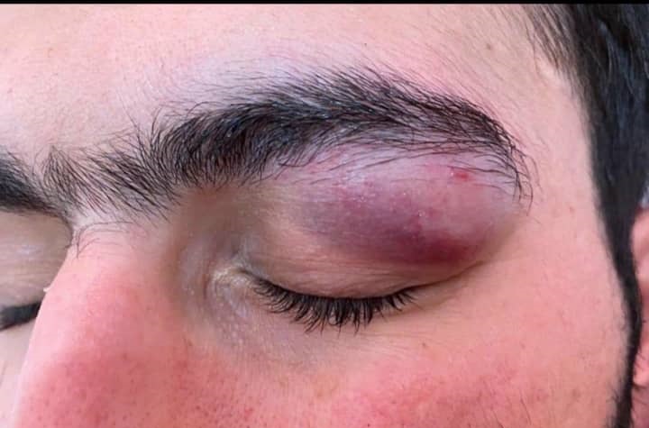حمله با سلاح سرد به کادر درمان در بندرعباس
